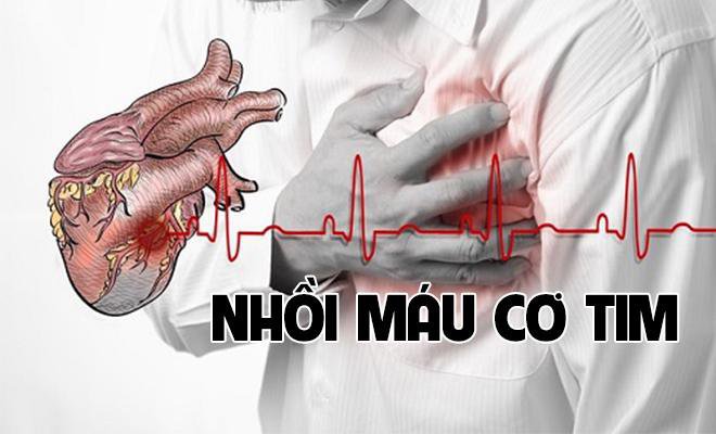 Nhồi máu cơ tim – Bệnh có nguy cơ gây tử vong cao